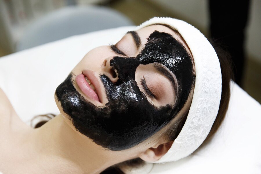 Carbon Peel Treatment in Gagan Vihar, Delhi