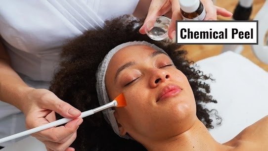 Chemical Peel Treatment in Karkardooma